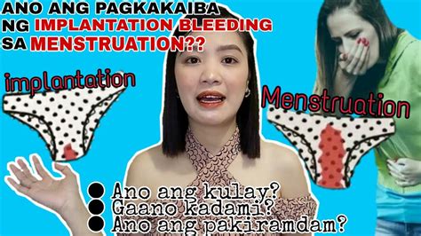 Ano Ang Spotting .